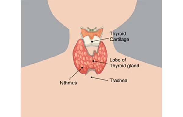 Thyroidectomy