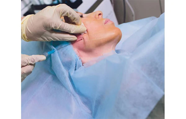 Superficial Parotidectomy